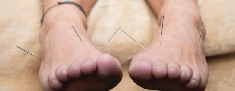 Feet with acupuncture needles